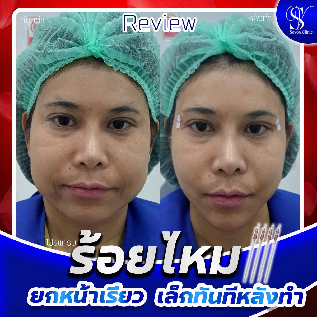 480618559_506223829181942_6347527631366715160_n