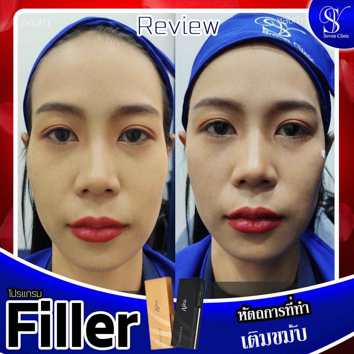 482008513_519849937819331_2100747932160902277_n