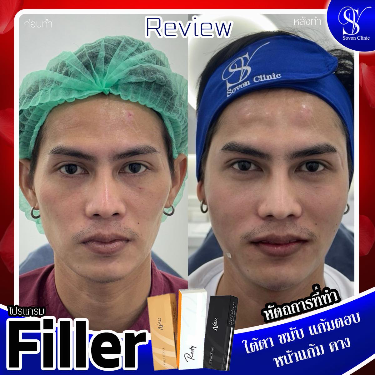 482356807_522071844263807_4610154501577441084_n