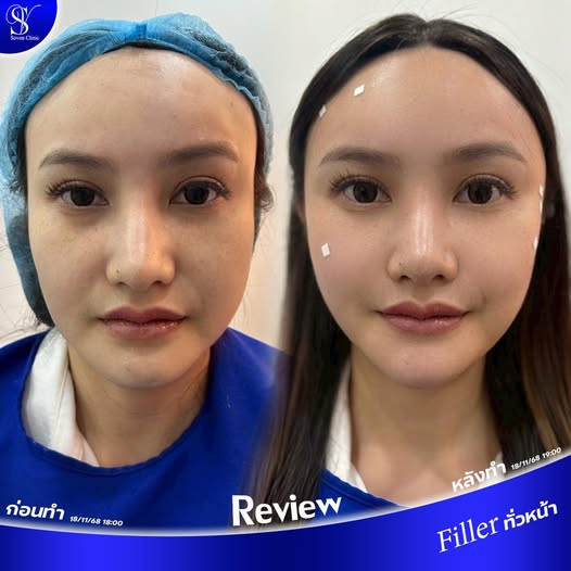 591872735_122274436988023019_5932204540801930472_n