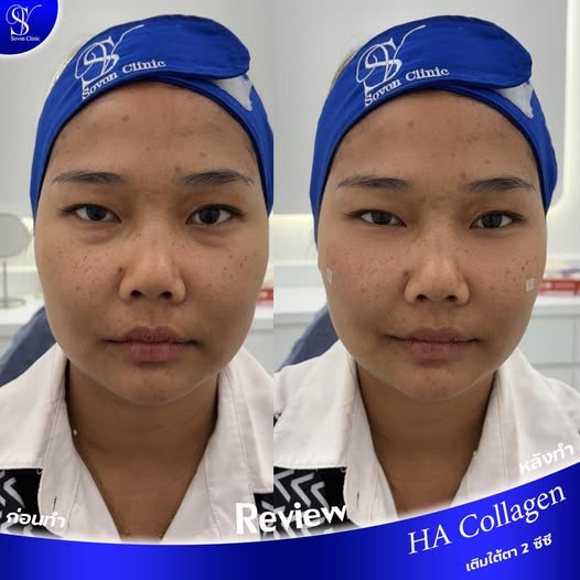 592191335_122274435038023019_6801371733553542749_n