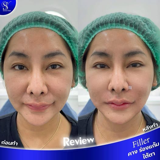 594151498_122274442646023019_7782487272497589319_n