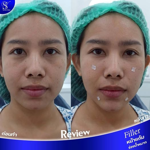 594393970_122274443054023019_564920003939502928_n