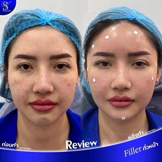 601848552_122276439764023019_8330880796120781151_n